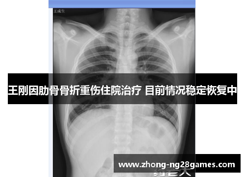 王刚因肋骨骨折重伤住院治疗 目前情况稳定恢复中 王刚因肋骨骨折重伤住院治疗 目前情况稳定恢复中